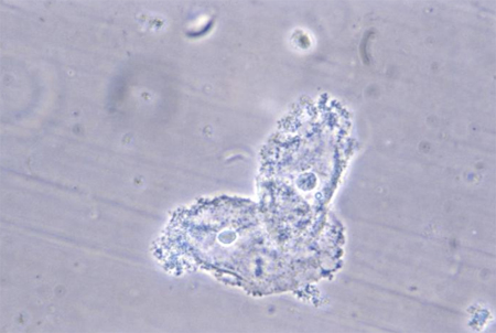 Assessment of recurrent miscarriage images