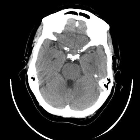 Assessment of pituitary mass images