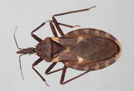Chagas disease images