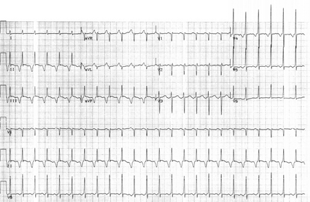 Assessment of hypotension images