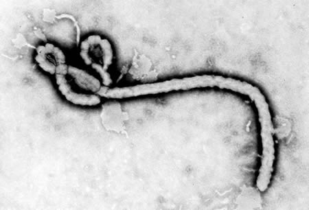 Infección por el virus del Ébola images