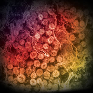 Middle East respiratory syndrome (MERS) images
