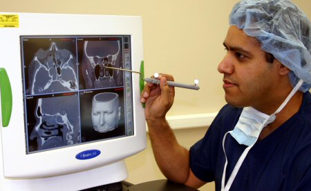 Chronic rhinosinusitis without nasal polyps images