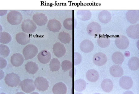 Malaria images