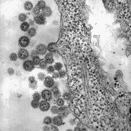 South American haemorrhagic fevers images