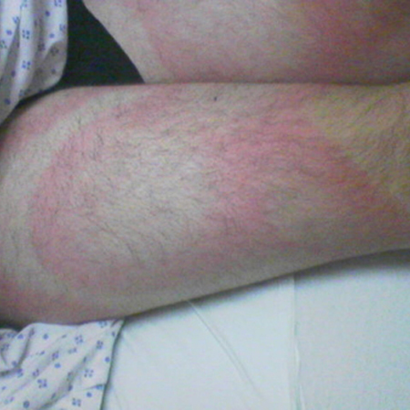 com.bmj.content.model.Caption@5ba27d00