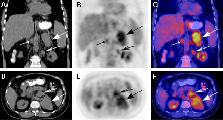 Assessment of hirsutism images