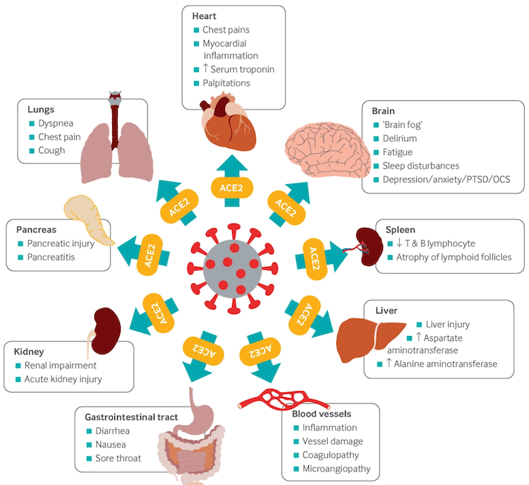 Multi-organ complications of COVID-19 and long COVID. The SARS-CoV-2 virus gains entry into the cells of multiple organs via the ACE2 receptor