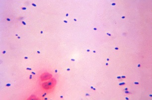 Bacterial meningitis in children images