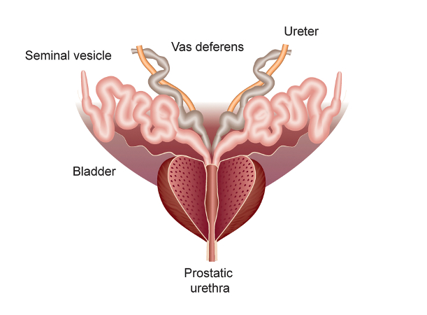 Primary prostate pain syndrome images