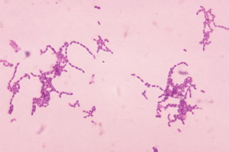  species bacteria