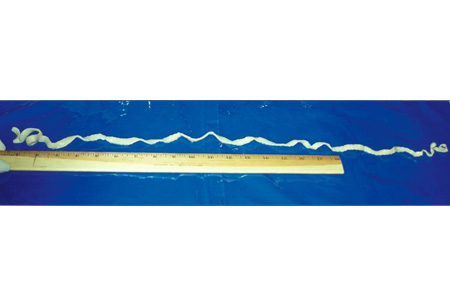 Tapeworm infection images