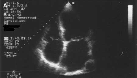Evaluation of cardiomyopathy images