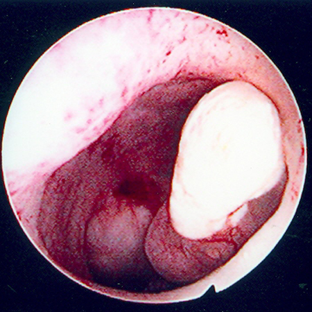 Assessment of dysmenorrhoea images