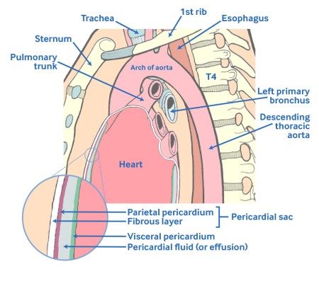 Evaluation Of Pericardial Effusion - Images 