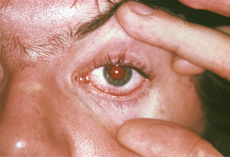 com.bmj.content.model.assessment.Caption@50b2d1a2