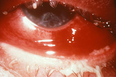 com.bmj.content.model.assessment.Caption@45a3883