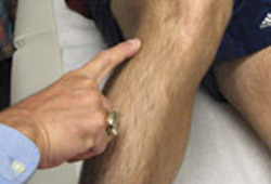 Evaluation of knee injury images
