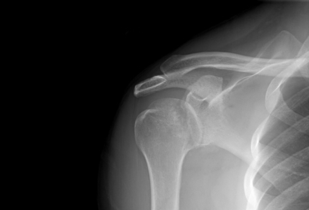 Joint dislocation images