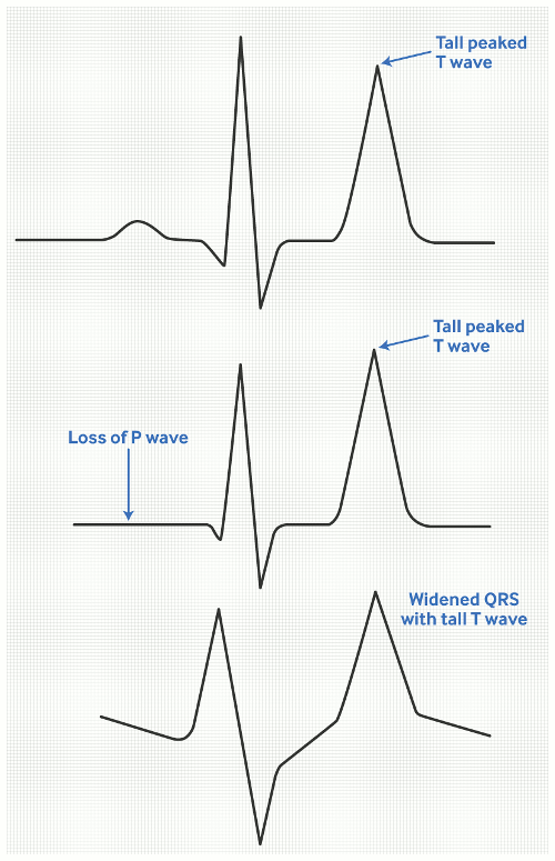 com.bmj.content.model.assessment.Caption@481b4fc