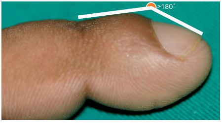 com.bmj.content.model.assessment.Caption@66581b8c
