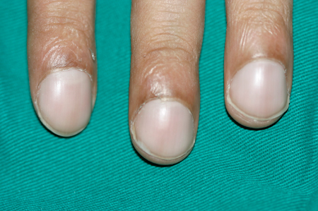 Things Your Nails Can Tell You About Your Health – Femanin