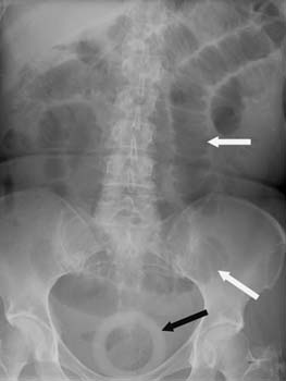 Assessment of nausea and vomiting, adults images