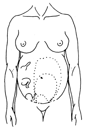 Assessment of abdominal pain in pregnancy images