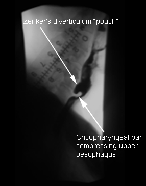 com.bmj.content.model.assessment.Caption@15c2f52f