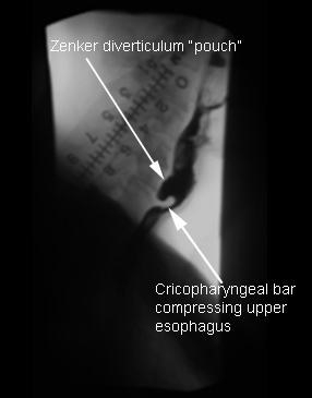 com.bmj.content.model.assessment.Caption@46918882