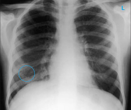 com.bmj.content.model.assessment.Caption@6e329c0d