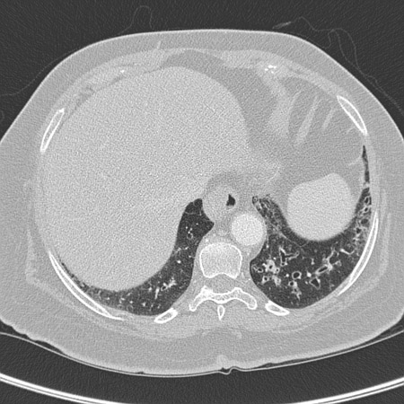 com.bmj.content.model.assessment.Caption@14b1fd9a