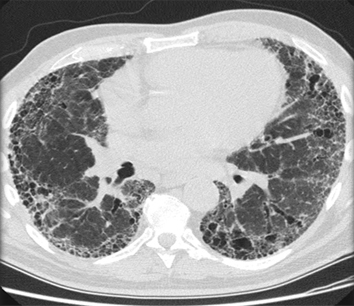 com.bmj.content.model.assessment.Caption@59516bca