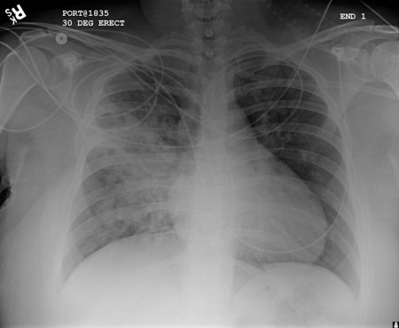 com.bmj.content.model.assessment.Caption@3f24807