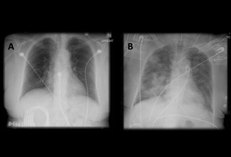 com.bmj.content.model.assessment.Caption@5fe6c833