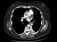 com.bmj.content.model.assessment.Caption@1fc586b0