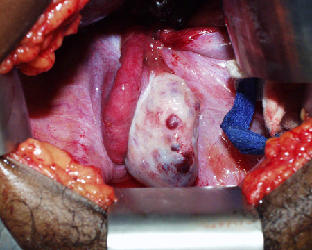 com.bmj.content.model.assessment.Caption@41027cc3