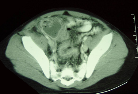 com.bmj.content.model.assessment.Caption@5048cb29