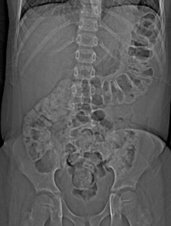 com.bmj.content.model.assessment.Caption@7ca5395a