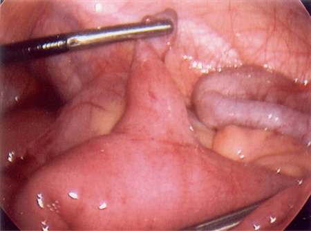 com.bmj.content.model.assessment.Caption@151772e3