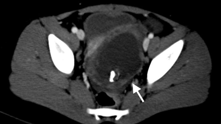 com.bmj.content.model.assessment.Caption@783655da