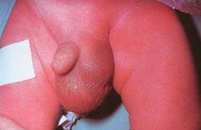 com.bmj.content.model.assessment.Caption@4862851c