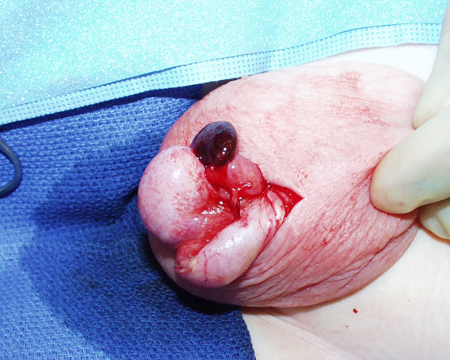 com.bmj.content.model.assessment.Caption@2b05b89c