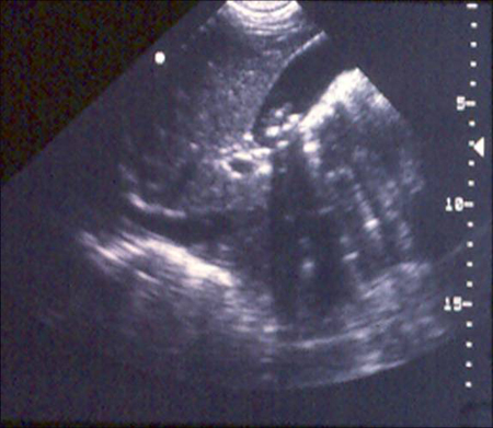 com.bmj.content.model.assessment.Caption@35189a5