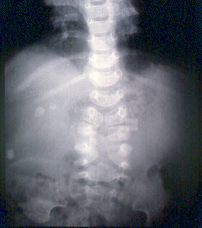 com.bmj.content.model.assessment.Caption@2372cc8d