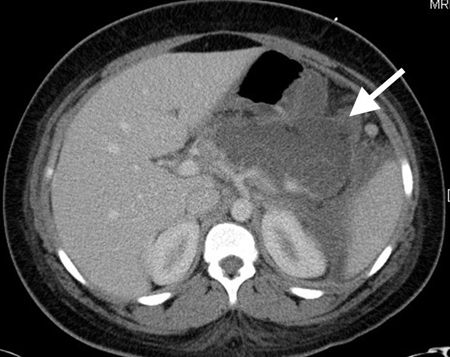 com.bmj.content.model.assessment.Caption@1752d894
