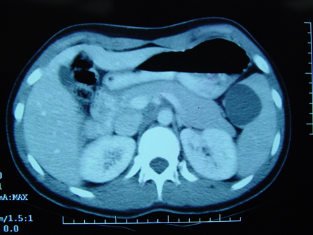 com.bmj.content.model.assessment.Caption@12600cf6