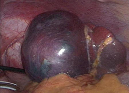 com.bmj.content.model.assessment.Caption@31c6105c