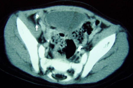 com.bmj.content.model.assessment.Caption@7ff6839f
