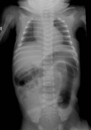 com.bmj.content.model.assessment.Caption@3fa437e2